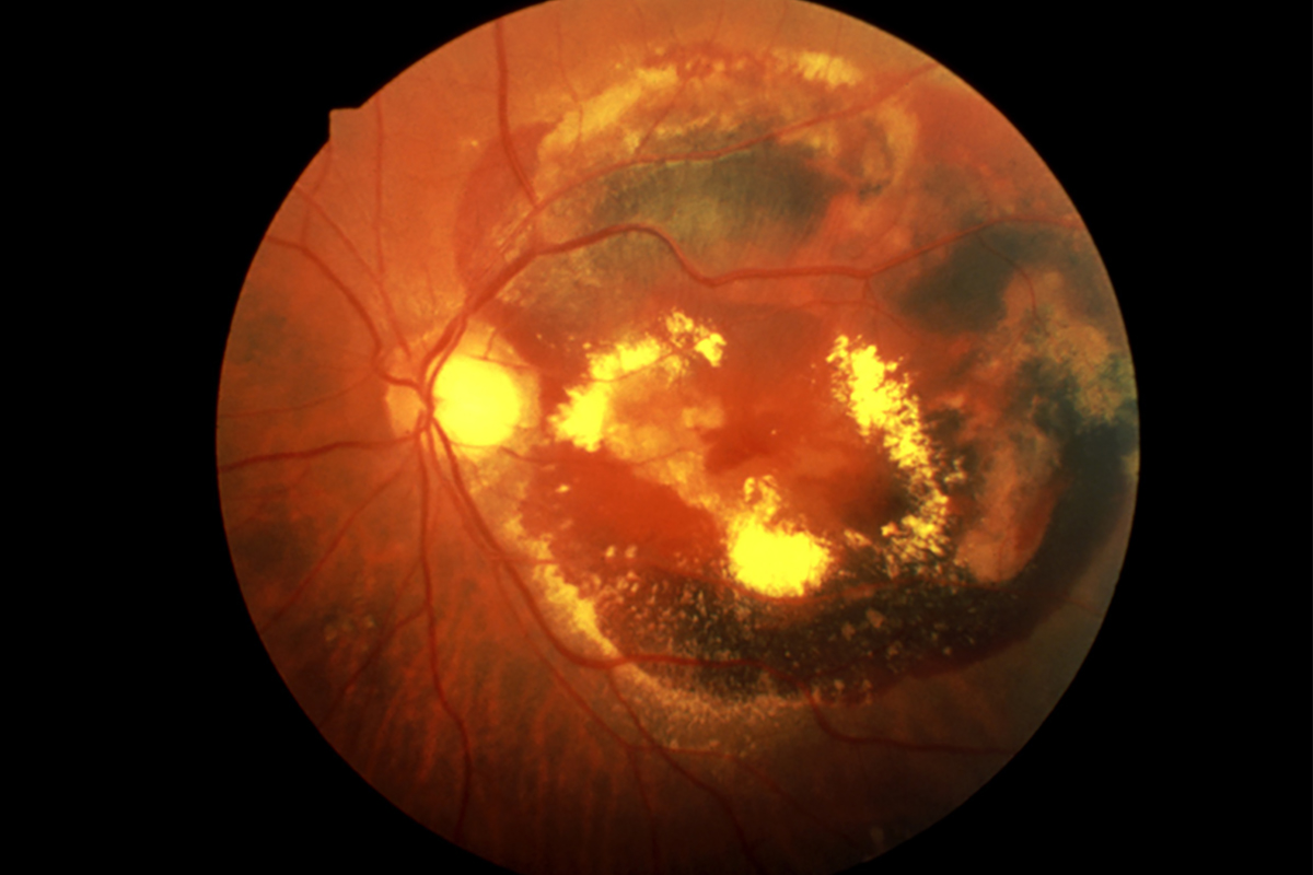 症状と原因の類似点